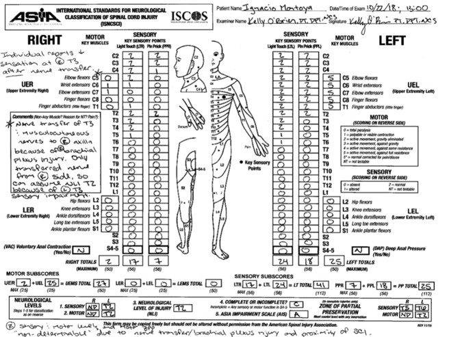 Case Report: Intensive Lokomat® Training in a Chronic Complete Spinal ...